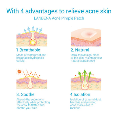 Invisible Overnight Acne Healing Patches