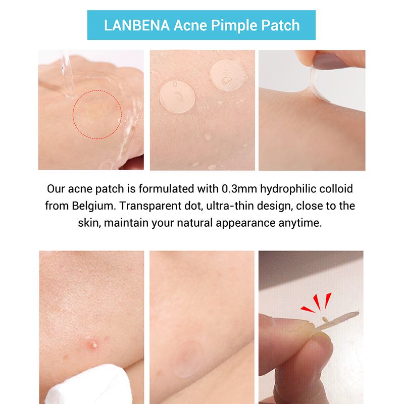 Invisible Overnight Acne Healing Patches