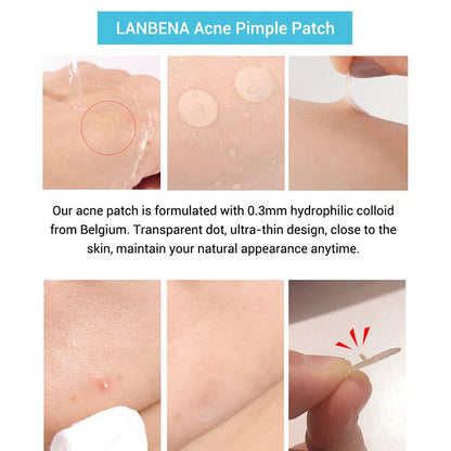 Invisible Overnight Acne Healing Patches